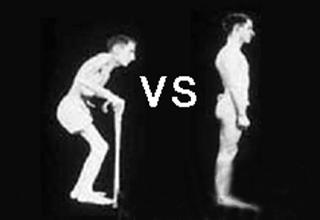 成都京研强直性脊柱炎研究院